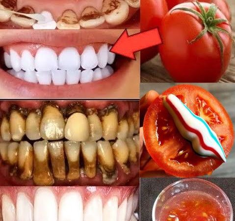 Whiten Your Teeth Naturally with Tomato & Baking Soda — In Just 2 Minutes!