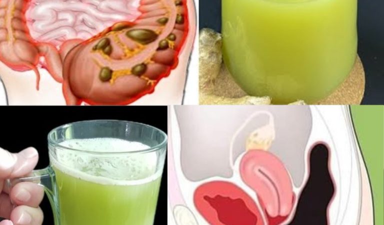 Lose Weight by Cleansing Your Colon in 7 Days