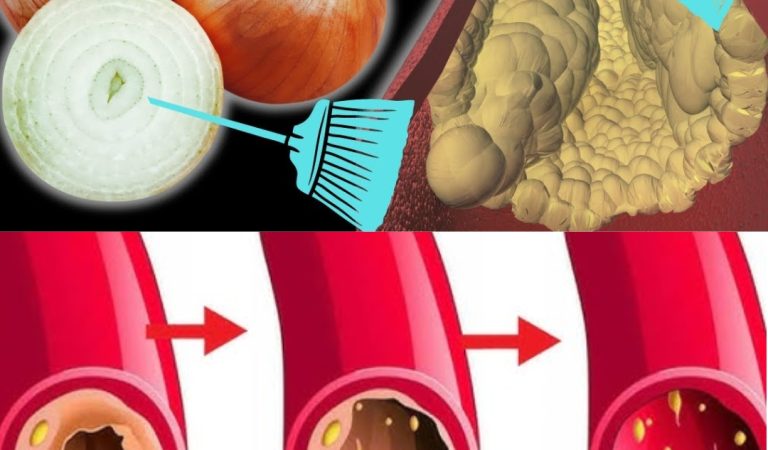 Top 10 Simple & Delicious Foods to Clear Clogged Arteries Top 10 Simple & Delicious Foods to Clear Clogged Arteries