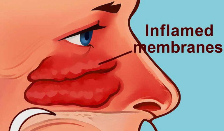 How to clear your sinuses with nothing but your fingers