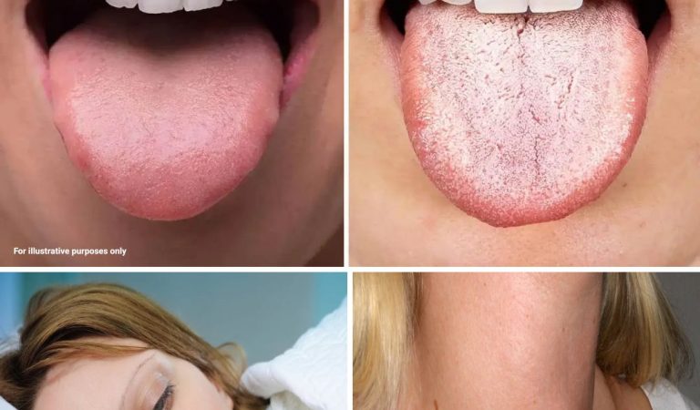 10 Possible Pre-Canc3r Symptoms That Are Better Not to Ignore