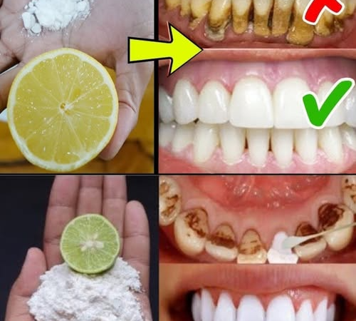 Ginger mixed with this will help whiten teeth and freshen your breath instantly