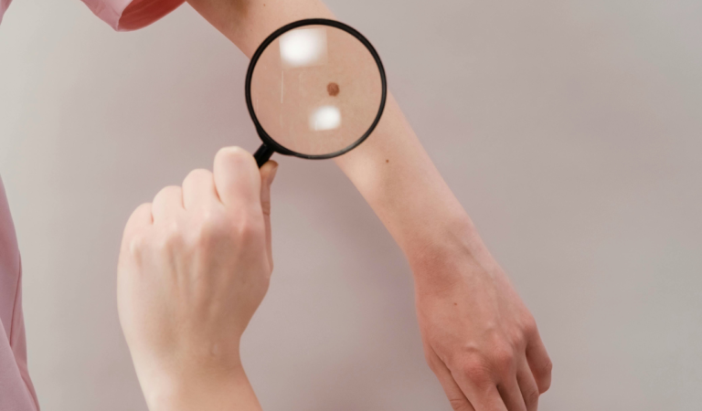 Doctor reveals two little-known signs of skin c-ancer that everyone misses Doctor reveals two little-known signs of skin c-ancer that everyone misses