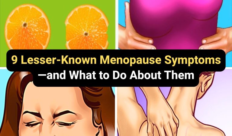9 Lesser-Known Menopause Symptoms—and What to Do About Them 9 Lesser-Known Menopause Symptoms—and What to Do About Them