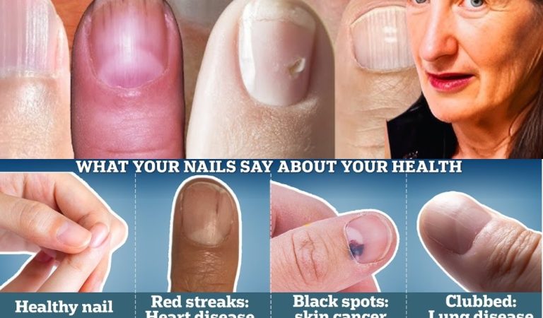 What Your Nails Might Be Telling You: 9 Subtle Signs to Notice