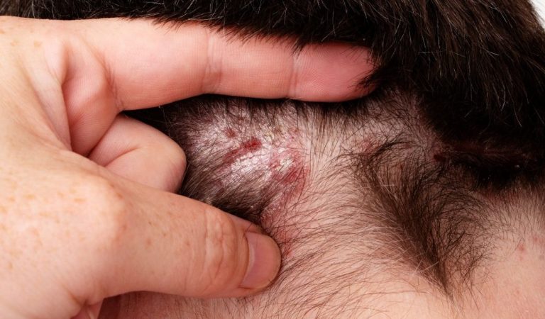Found this on my son’s scalp. Have no idea what it is and we can’t get a doc appt soon. Tips?