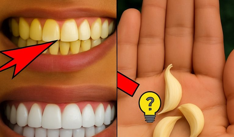 Garlic: The Hidden Key to Whiter Teeth You’ve Never Considered