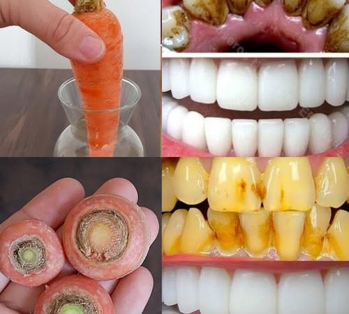 Brighten Your Smile Naturally—With Carrot Tops!