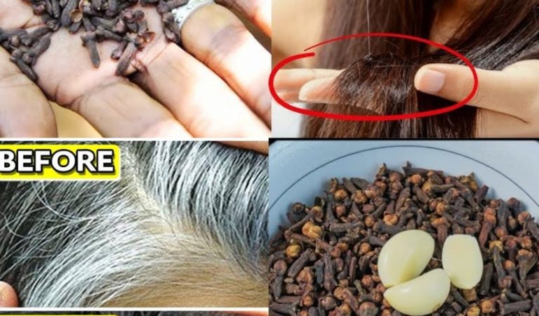 Reverse Gray Hair Naturally with Garlic & Cloves — No Chemicals Needed! Reverse Gray Hair Naturally with Garlic & Cloves — No Chemicals Needed!