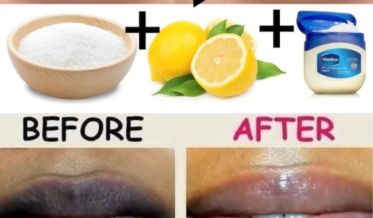 Rub This on Your Lips: I Got Super Soft, Pink Lips With No Pigmentation—Thanks to This One Slice! Rub This on Your Lips: I Got Super Soft, Pink Lips With No Pigmentation—Thanks to This One Slice!