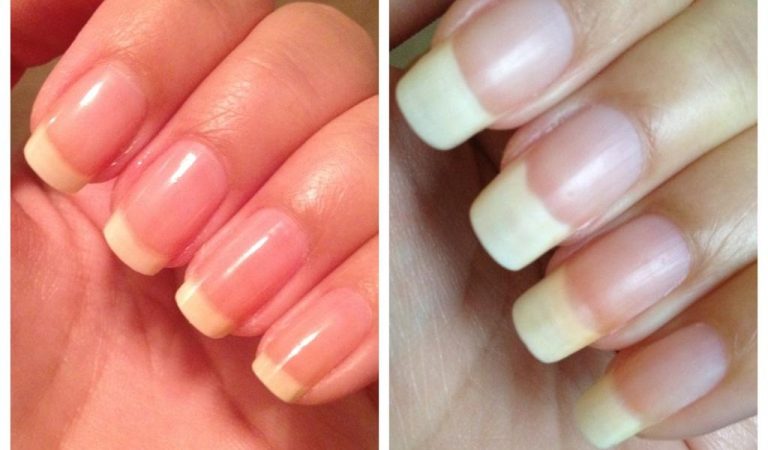 What It Really Means If Your Fingernails Grow Fast What It Really Means If Your Fingernails Grow Fast