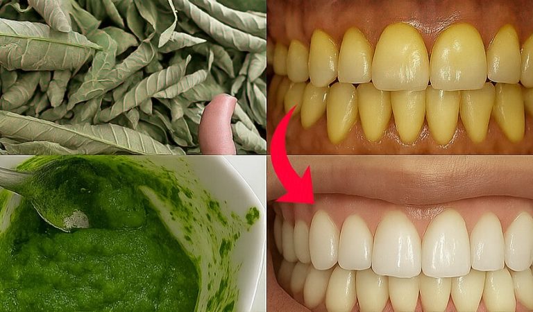 Guava Leaves: The Ancient Secret to a Radiant, Healthy Smile